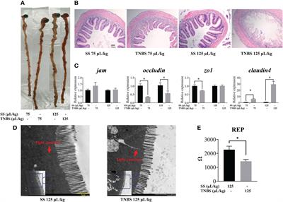 Enhancement of liver mitochondrial complex I and energy metabolism induced by enteritis: The key role of gut microbiota derived endotoxins